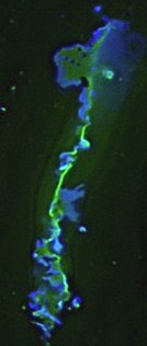 gap junction plaqe with GFP labels